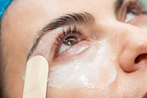 istock Application of topical anesthesia cream prior to a dermatological procedure. 2163506831