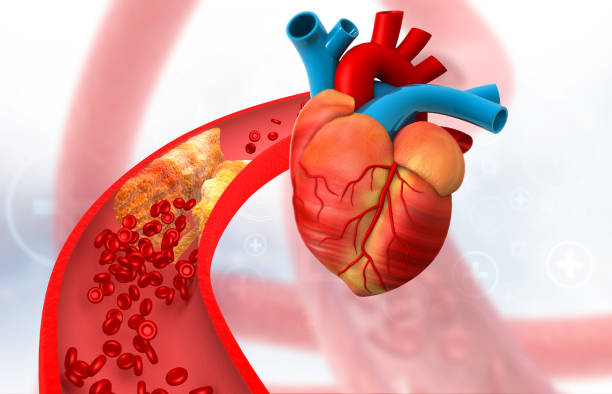 istock Human heart with cholesterol blocked artery 2163582039