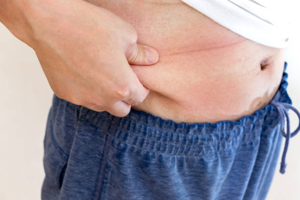 istock Pinch belly fat with fingers 2163719220