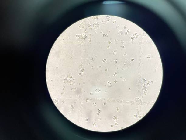 istock White blood cell in urine. 2163734256
