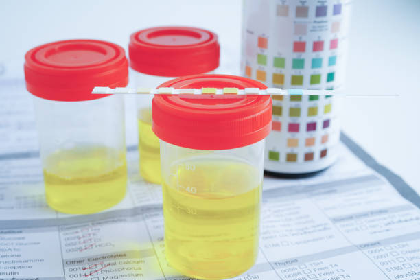 istock Urinalysis, urine cup with reagent strip pH paper test and comparison chart in laboratory. 2163763948