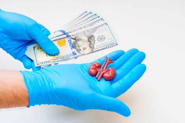 istock Money And Kidney Model In Hand 2163804336