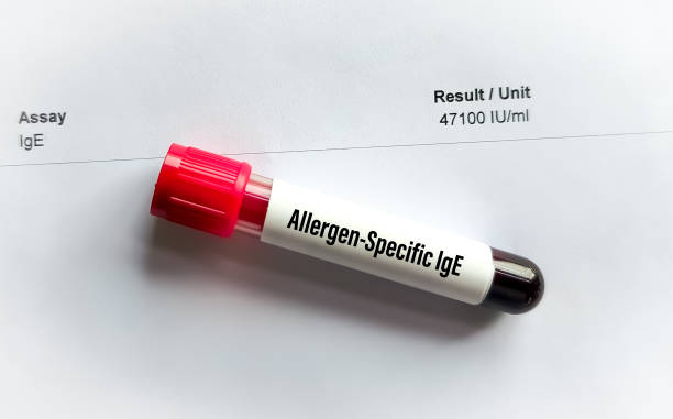 istock Blood sample isolated for Allergy specific IgE test with abnormal report. 2163875308