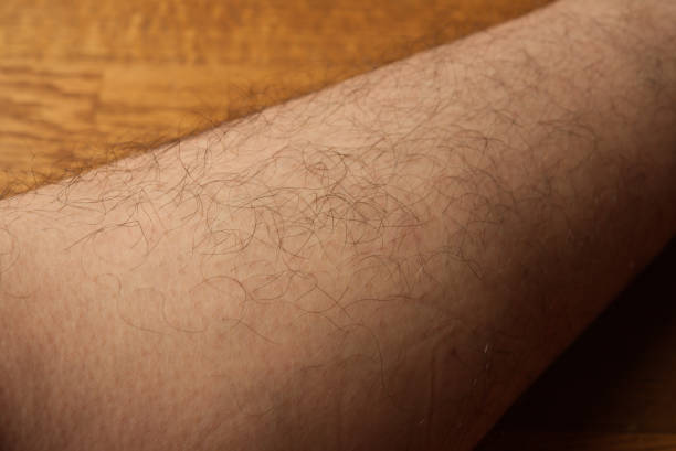 istock Leg hair 2163877817