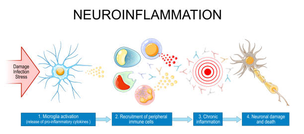 Neuroinflammation Neuroinflammation. Development of Neurodegenerative Diseases. From injury of brain, damage, infection or stress to Microglia activation, release of cytokines, chronic inflammation and Neuronal damage and death medulla stock illustrations