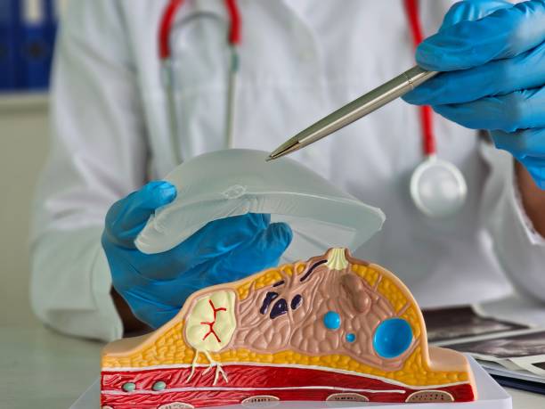 istock Doctor demonstrates breast implant rupture using an anatomical model 2164140325