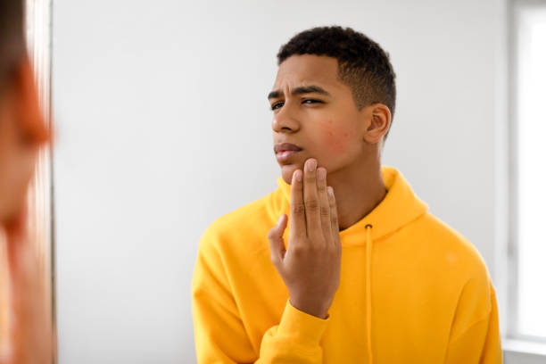 istock Concerned black teen guy examining face in the mirror 2164328079