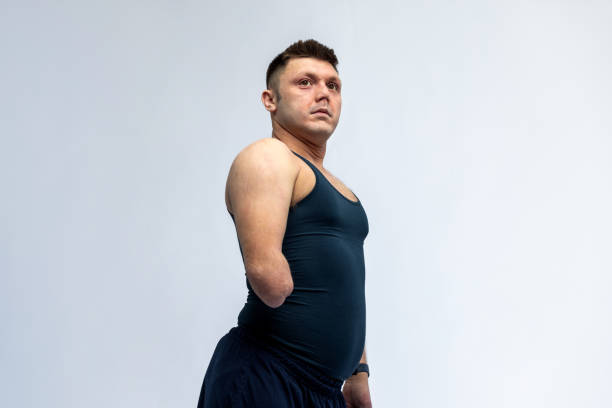 A waist-up shot of a young male adult athlete. He is a quadruple amputee who developed Meningitis as a baby, looking away from the camera wearing a blue navy vest and shorts expressing no emotion on his face - a white background in a studio.