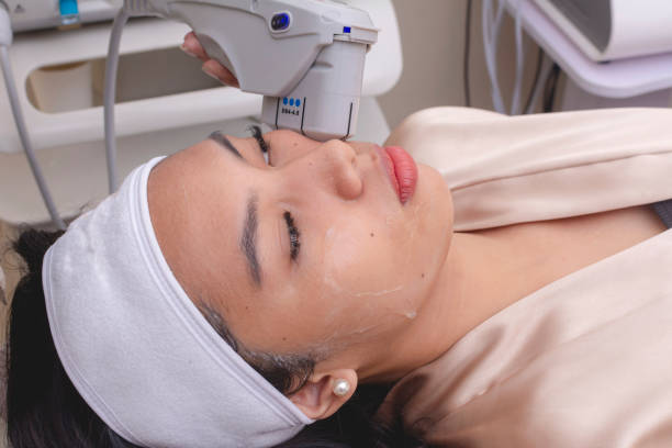A young woman undergoing HIFU treatment for her jawline. High Intensity Focused Ultrasound technology. At a skin care, dermatologist or aesthetic clinic. A young woman undergoing HIFU treatment for her jawline. High Intensity Focused Ultrasound technology. At a skin care, dermatologist or aesthetic clinic. venus versa treatment on face stock pictures, royalty-free photos & images A young woman undergoing HIFU treatment for her jawline. High Intensity Focused Ultrasound technology. At a skin care, dermatologist or aesthetic clinic. A young woman undergoing HIFU treatment for her jawline. High Intensity Focused Ultrasound technology. At a skin care, dermatologist or aesthetic clinic. venus versa treatment on face stock pictures, royalty-free photos & images