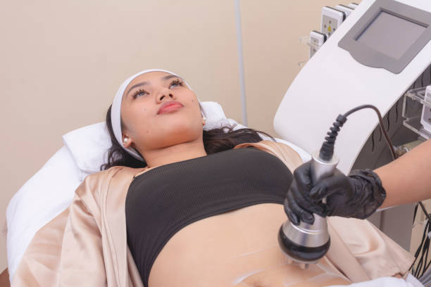 Using an RF electromagnetic device for radiofrequency abdomen tightening or waist slimming treatment. At a skin care, dermatologist or aesthetic clinic.
