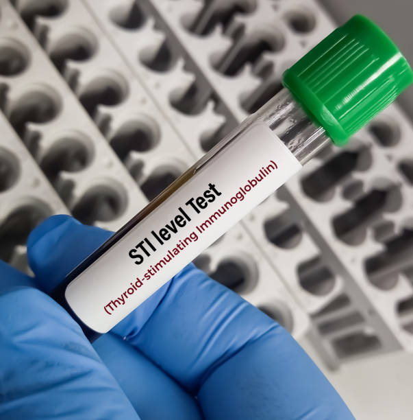 istock Blood sample for Thyroid stimulating Immunoglobulin (TSI) test. Throtropin binding inhibitory Immunoglobulin. Anti TSHR Ab. 2165097789