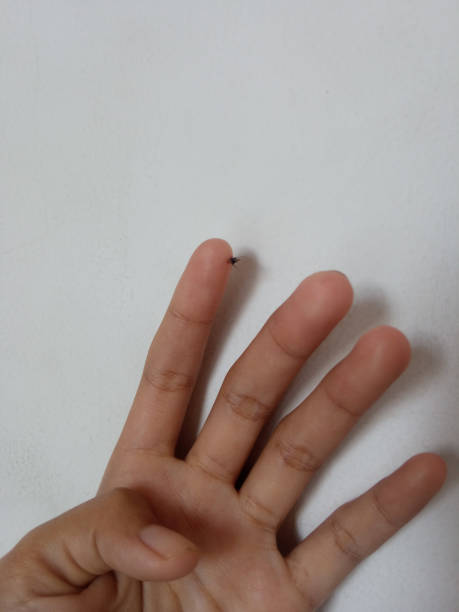 istock Asian woman hand bitten by mosquito isolate on white 2165278363