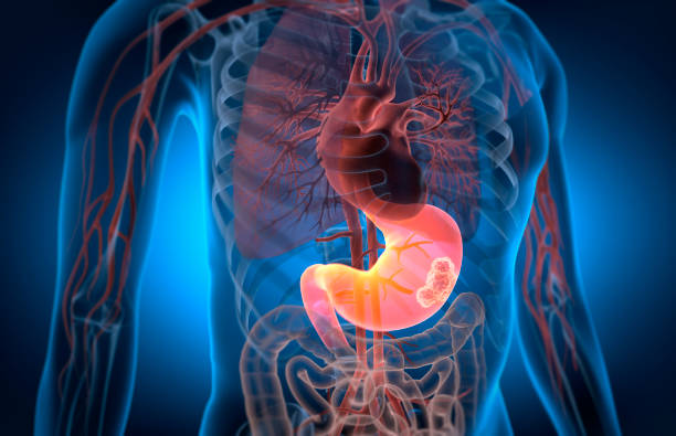 Abdominal Diagnostic Imaging
