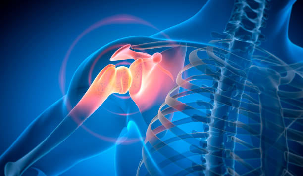 istock Man with strong pain in shoulder with dark blue background - X Ray Illustration 2165383048