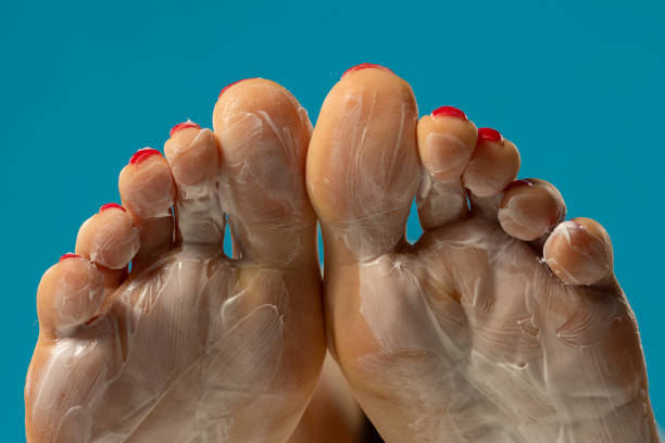 istock Female soles with foot mask on blue studio background. 2165413198