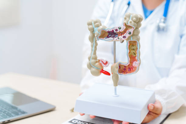 istock A doctor holds a human colon anatomy model, demonstrating the digestive system's structure to diagnose and treat various gastrointestinal diseases and conditions. 2165545434