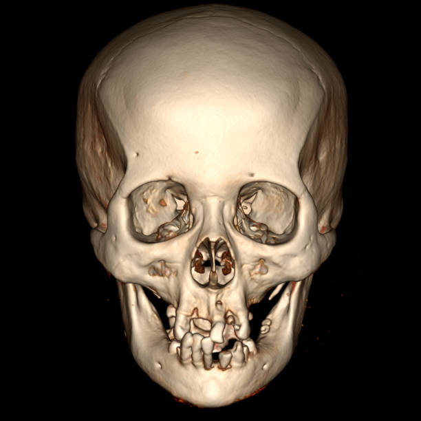 istock 3-DIMENSIONAL IMAGES ON CT SCAN-MRI 2165638162