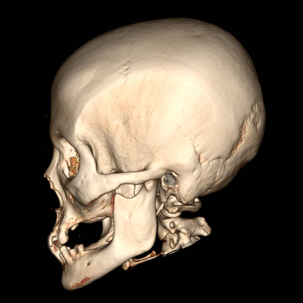 istock 3-DIMENSIONAL IMAGES ON CT SCAN-MRI 2165638163