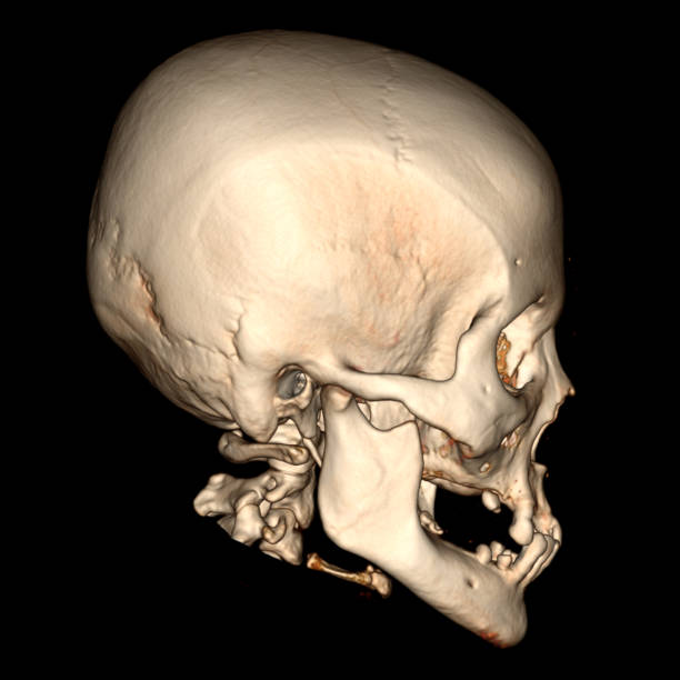 istock 3-DIMENSIONAL IMAGES ON CT SCAN-MRI 2165638164