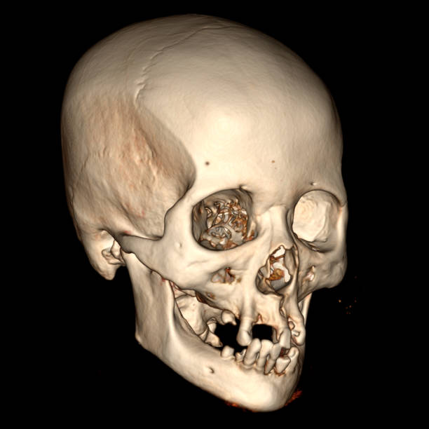 istock 3-DIMENSIONAL IMAGES ON CT SCAN-MRI 2165638170