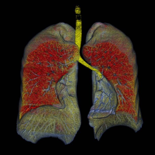 istock CT Scan or MRI Chest or Lung 3d 2165638203