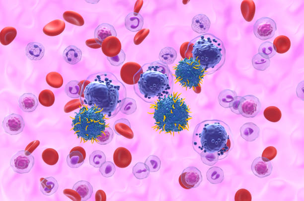 CAR T cell therapy in Acute myeloid leukaemia (AML) - isometric view 3d illustration stock photo