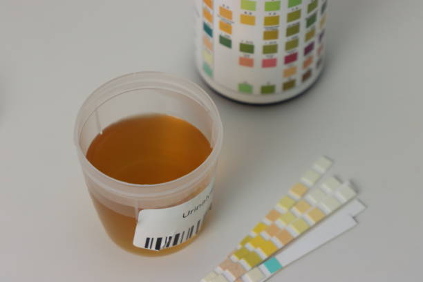 istock Urine sample in a bottle in a white surface with reagente strips for urinalysis 2165932506