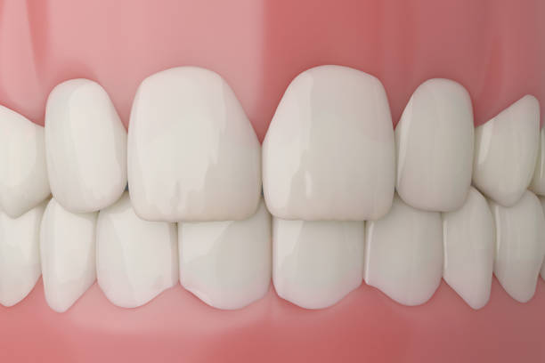istock White teeth and healthy gums 2165964869