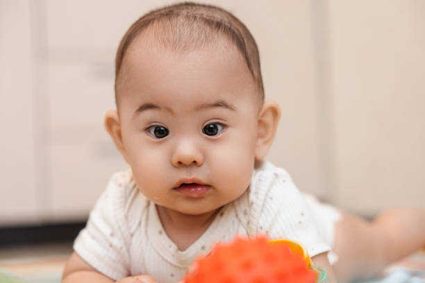 istock An infant diagnosed with trigonocephaly after the first operation with a scar on his head 2165965416