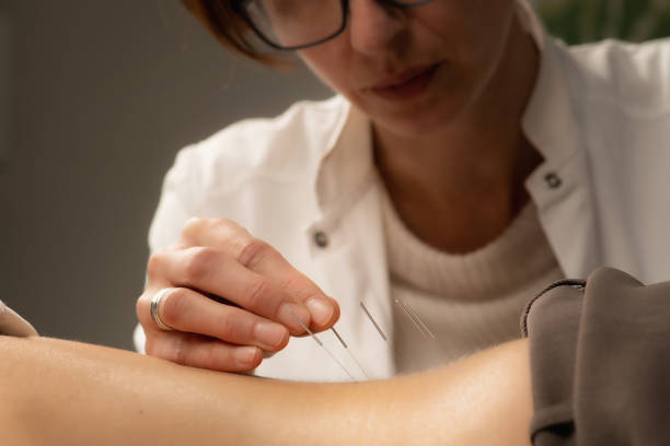 istock Acupunturist treating patient chronic back pain 2165982107