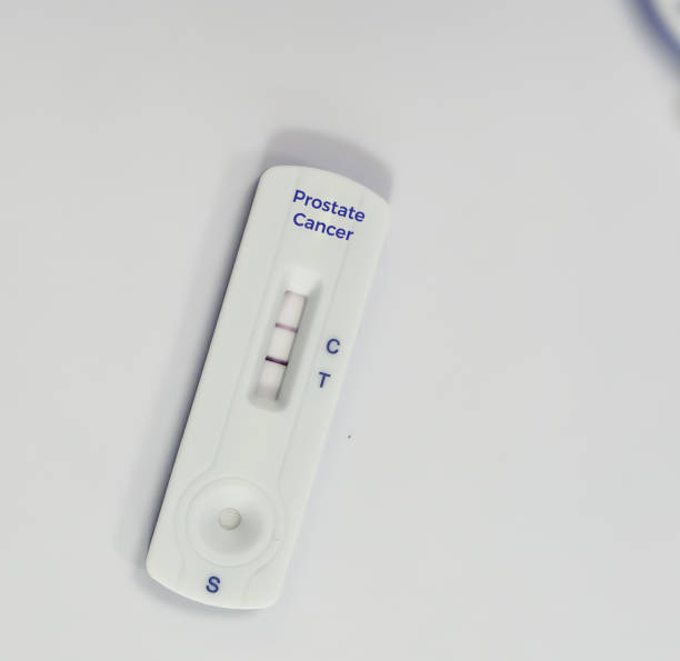 istock Rapid test device for Prostate cancer test isolated on black keyboard with text stop 2165988795