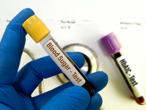 diabetic panel, blood sugar and hba1c testing concept. - diabetes potret stok, foto, & gambar bebas royalti