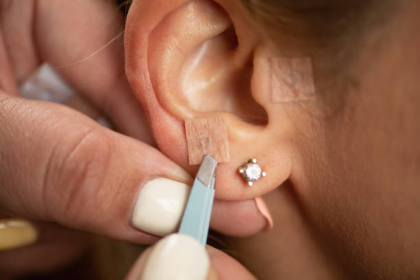 istock Auriculotherapy stimulates pressure points on the ear 2166495871