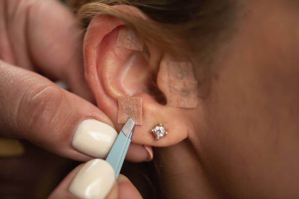 istock Acupuncturist stimulating auricular acupuncture points for treating anxiety 2166495981