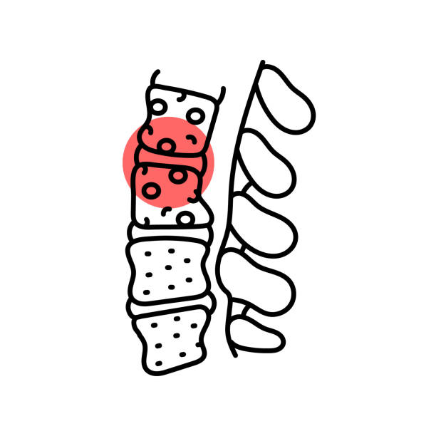 Osteoporosis color line icon. Diseases of the spine Osteoporosis color line icon. Diseases of the spine. Vertebrology. Vector isolated element. Editable stroke. femur bone anatomy drawing stock illustrations
