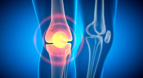istock Pain in knee joint 2166640293