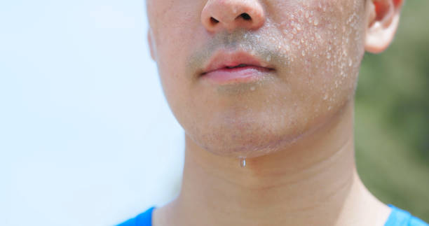 istock closeup asian man face sweating 2167298891