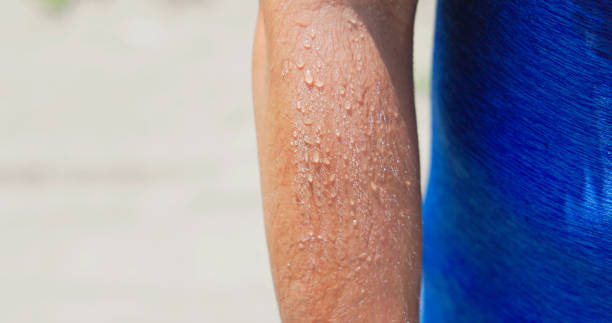 istock closeup asian man arm sweating 2167298911