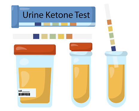 Acetone Lab Color Tube Acetone Test Strips And Test Tubes With Urine Urine Ketone Test Stock ...