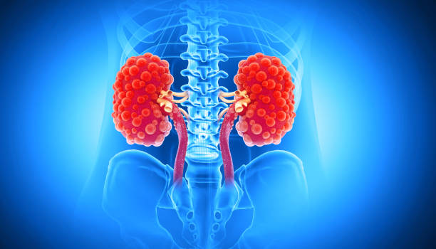 istock Visual concept of Kidney disease. 3d illustration 2167784456