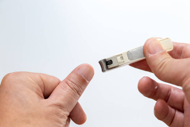 istock Cut a thumb nail with nail clippers 2167824081