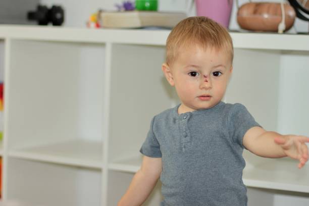 istock A small child with a wound on his nose tries to explain something 2167962243