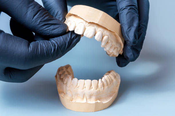 istock Dental plaster jaw model being held in gloved hands 2168027199