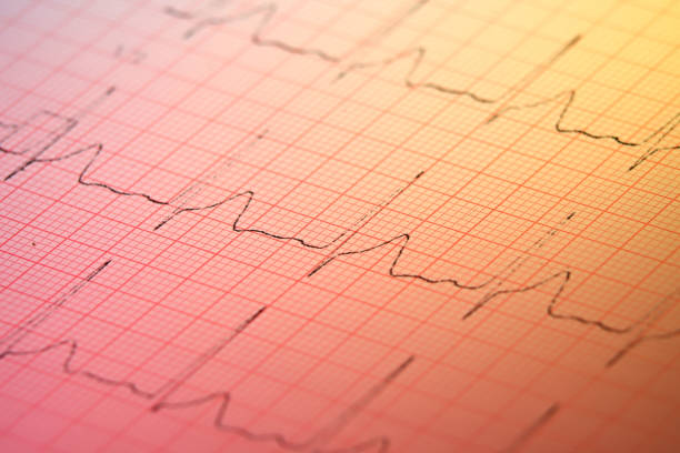 elektrokardiogram heart rate measurement chart
