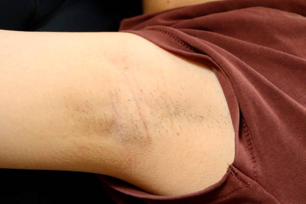 istock A woman's underarm hair that has not been treated for some time. 2168317102