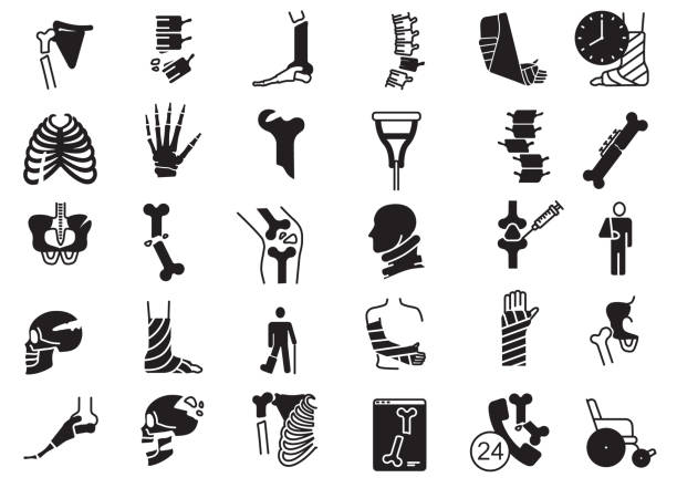 Orthopedic and Injury Icon Set in Black Featuring Bones, Joints, and Medical Devices A comprehensive set of black icons focused on orthopedics and injuries. This collection includes symbols representing bones, joints, fractures, medical devices, and related healthcare elements, ideal for medical, healthcare, and anatomy-related projects. broken ankle stock illustrations