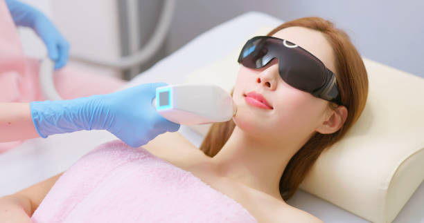 istock Woman face laser hair removal 2168394085