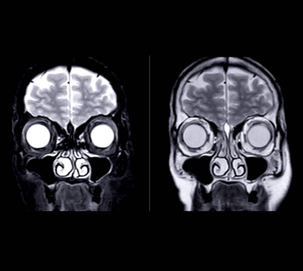 istock Image of MRI orbit scan with gadolinium contrast in normal case displays comprehensive views for eye disease diagnosis. 2168489970