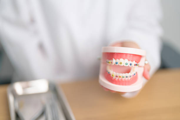 Dentist with Orthodontic tooth model and bracket or brace. Clean and Scrape off tartar. May Orthodontic Health Day, March Oral health, Dentist Day, False Teeth. Toothache and Children Dental Health