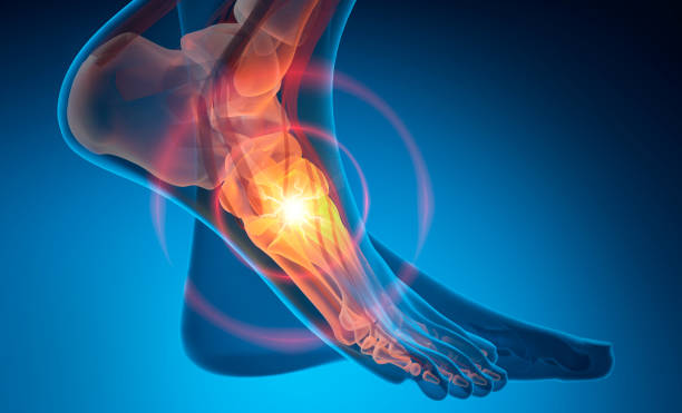 istock Human ankle with strong pain symptom 2168610985
